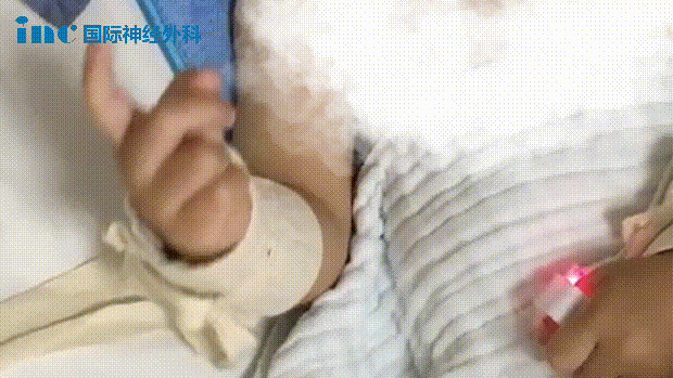 北京天壇醫(yī)院手術(shù)紀(jì)實(shí) - 母子連心戰(zhàn)勝腦干膠質(zhì)瘤，全家人的